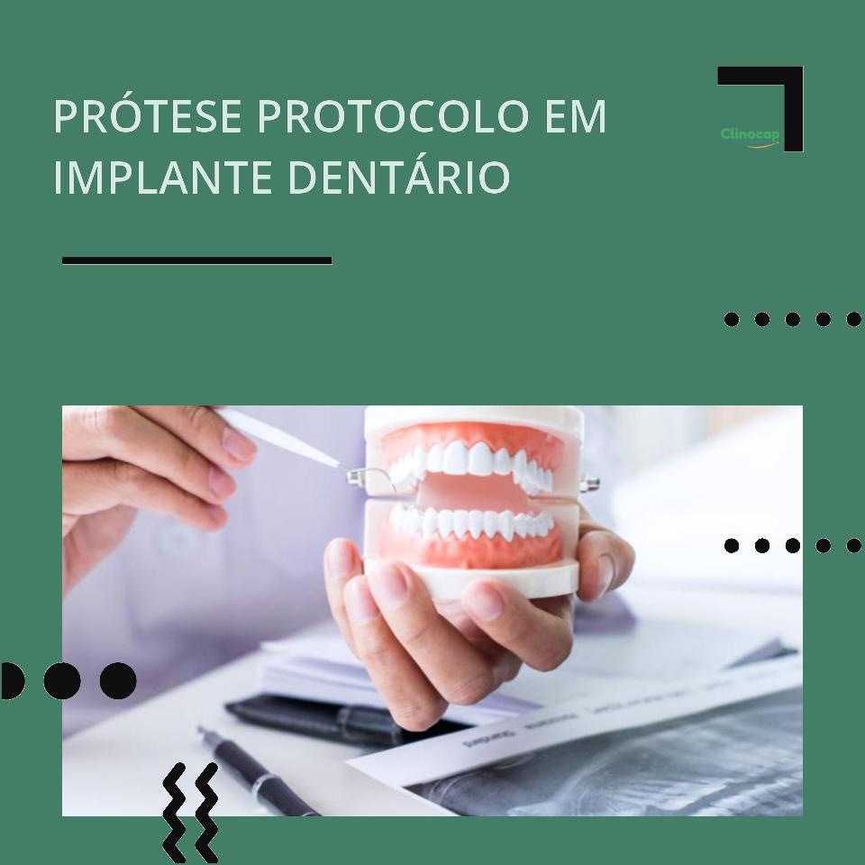 protese protocolo clinocap.jpg