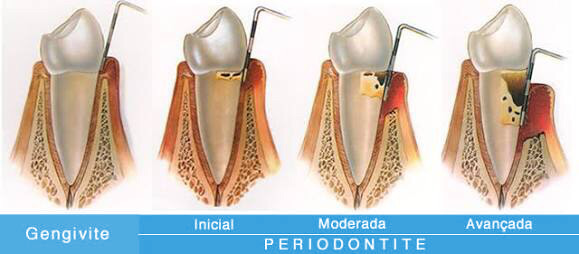texto_periodontia.jpg